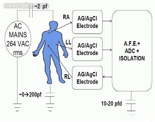 心电图(ECG)设计六大挑战与解决方案